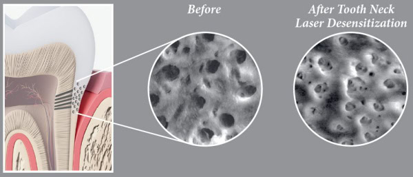 before_and_after