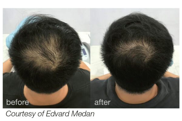 hairestart_web_b_a_courtesy_of_edvard_medan