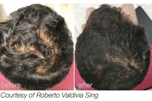 hairestart_web_b_a_courtesy_of_roberto_valdivia_sing