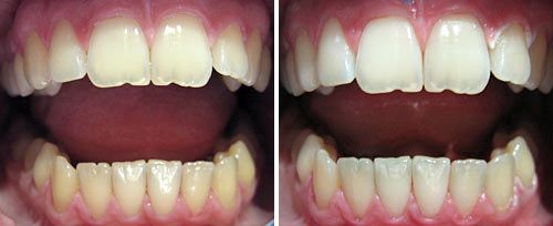 whitening_dr_mironov