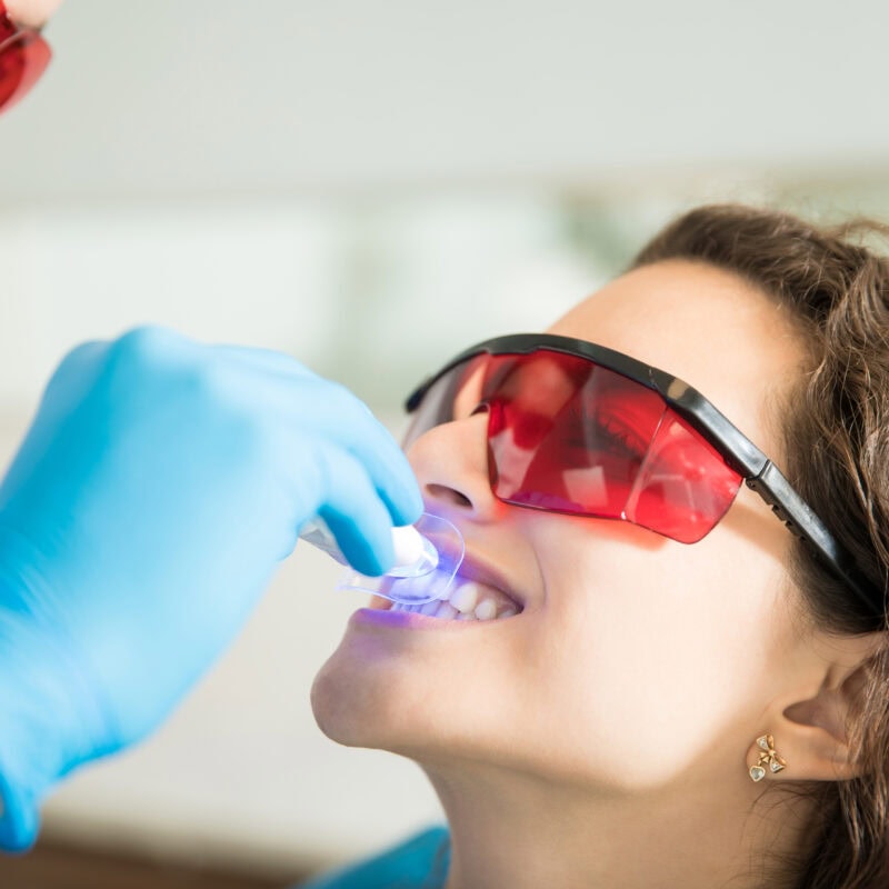Dental Laser Machines