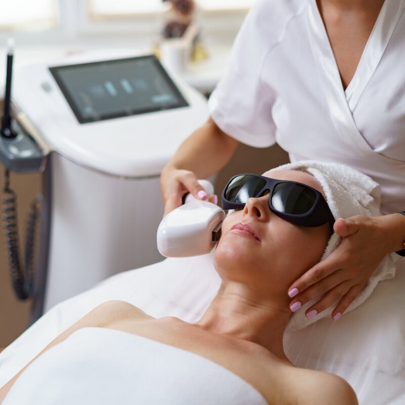 Laser Skin Treatments