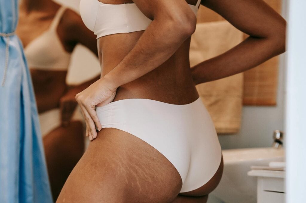 Fotona TightSculpting