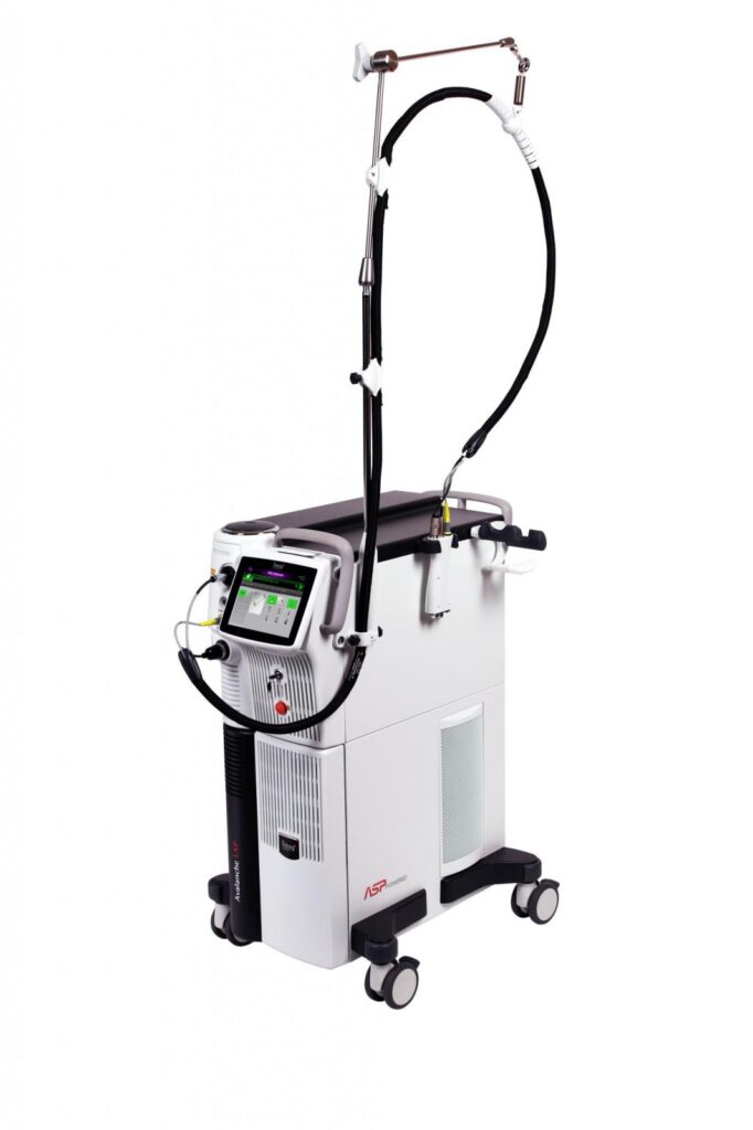 YAG Hair Removal