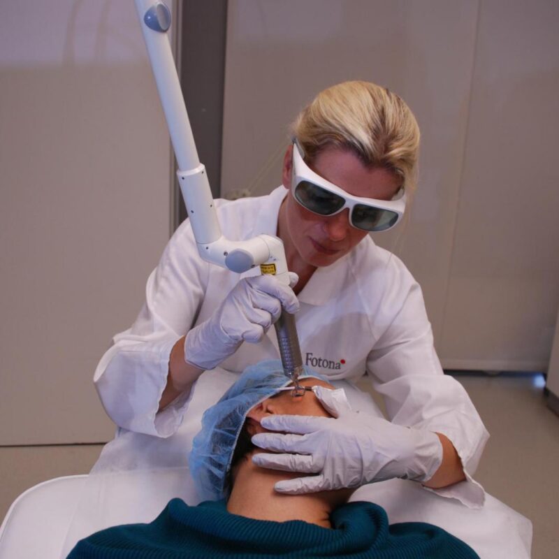 Aesthetic laser machine